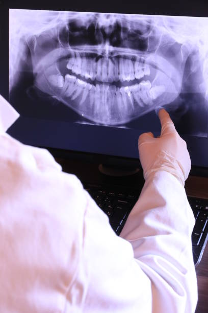 Best Knocked-Out Tooth Emergency  in Edgefield, SC